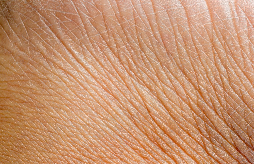 Nahaufnahme von reifer Haut.